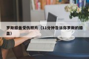 罗斯膝盖受伤照片（11分钟告诉你罗斯的膝盖）